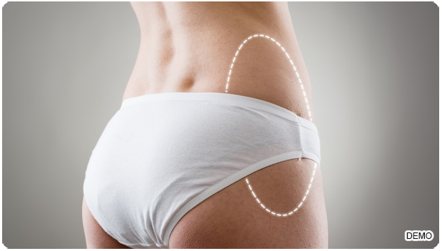 Botox Treatment